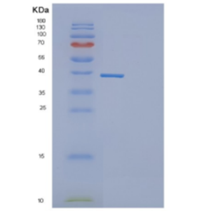 Recombinant Human DEDD Protein,Recombinant Human DEDD Protein