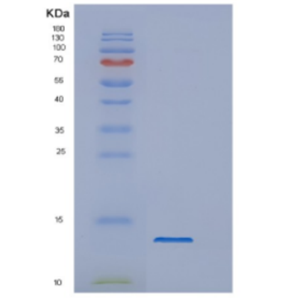 Recombinant Dengue virus 2DENV Protein,Recombinant Dengue virus 2DENV Protein