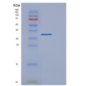 Recombinant Human DFFA Protein