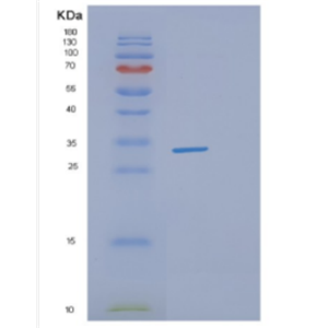 Recombinant Human DHRS4 Protein,Recombinant Human DHRS4 Protein