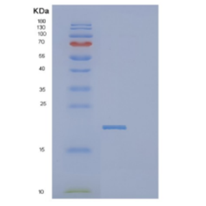 Recombinant Human DCTPP1 Protein