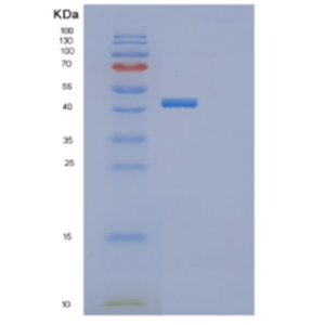 Recombinant Human DDR2 Protein