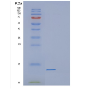 Recombinant Human DEFB118 Protein,Recombinant Human DEFB118 Protein