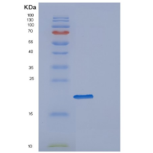 Recombinant Human DESI1 Protein,Recombinant Human DESI1 Protein