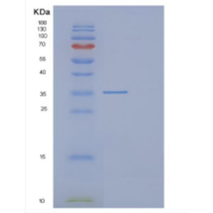 Recombinant Human DCUN1D4 Protein,Recombinant Human DCUN1D4 Protein