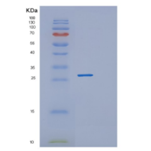 Recombinant Human DGCR6L Protein,Recombinant Human DGCR6L Protein