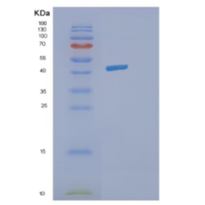 Recombinant Human DHPS Protein,Recombinant Human DHPS Protein