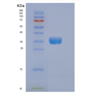 Recombinant Human DKK3 Protein,Recombinant Human DKK3 Protein