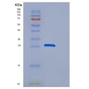 Recombinant Human DNAJC12 Protein,Recombinant Human DNAJC12 Protein