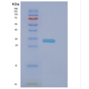 Recombinant Human DNAJC27 Protein,Recombinant Human DNAJC27 Protein