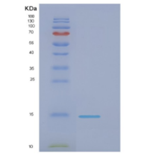 Recombinant E.coli Dnak(508-638); A lid covering the substrate Protein