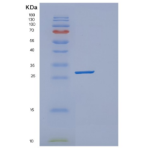 Recombinant Human deoC Protein,Recombinant Human deoC Protein