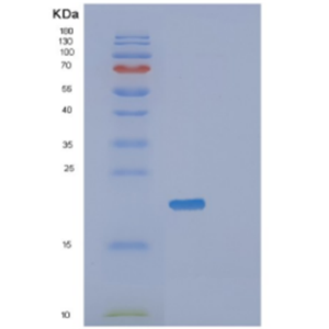 Recombinant Human Diamine N-acetyltransferase 1 Protein