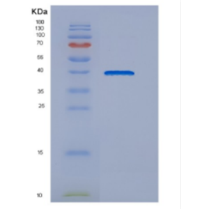 Recombinant Human DNAJB4 Protein,Recombinant Human DNAJB4 Protein