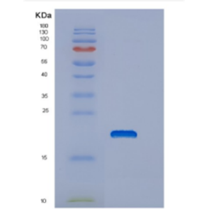 Recombinant Human DNAJC24 Protein,Recombinant Human DNAJC24 Protein