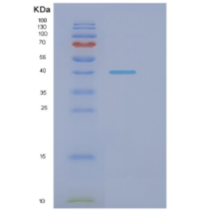 Recombinant E.coli Dnak(N-term;1-384) Protein