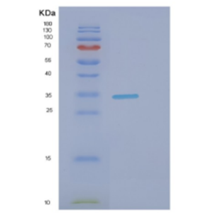 Recombinant Human DNALI1 Protein