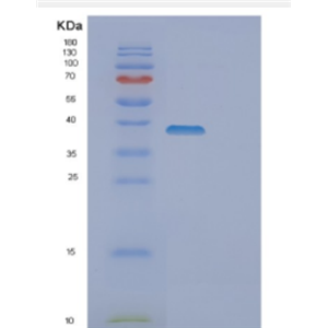 Recombinant Human DOK4 Protein,Recombinant Human DOK4 Protein