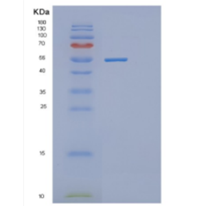 Recombinant Human DDX56 Protein,Recombinant Human DDX56 Protein