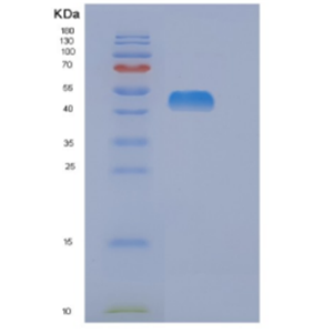 Recombinant Human DLD Protein,Recombinant Human DLD Protein