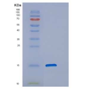 Recombinant Human DNAJC19 Protein,Recombinant Human DNAJC19 Protein