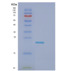 Recombinant Human DNAL1 Protein,Recombinant Human DNAL1 Protein