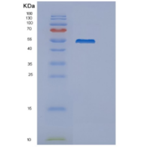 Recombinant Mouse Delta-like protein 4 Protein,Recombinant Mouse Delta-like protein 4 Protein