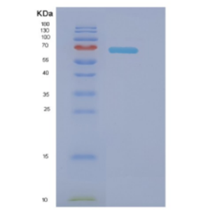 Recombinant E.coli Dnak (full length; 1-638) Protein