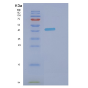 Recombinant Human DNMT3L Protein,Recombinant Human DNMT3L Protein