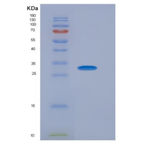 Recombinant Cluster Of Differentiation 26 (CD26)