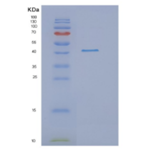 Recombinant Human DRG1 Protein