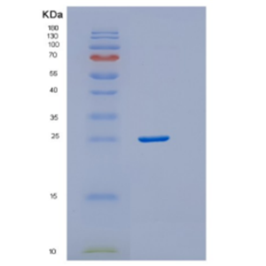 Recombinant Human DTD1 Protein,Recombinant Human DTD1 Protein