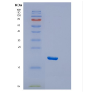 Recombinant Human DTD2 Protein,Recombinant Human DTD2 Protein