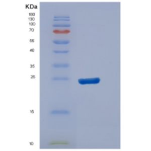 Recombinant Human DUSP13 Protein