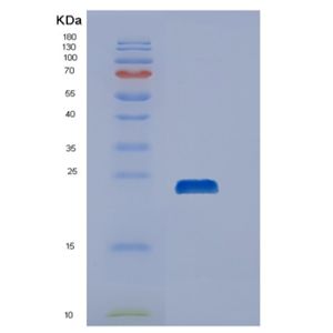 Recombinant Human DUSP21 Protein,Recombinant Human DUSP21 Protein