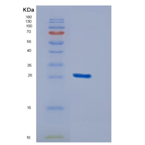 Recombinant Human DUSP26 Protein,Recombinant Human DUSP26 Protein