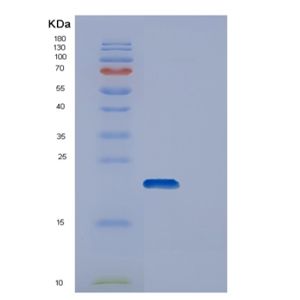 Recombinant Human DUT Protein