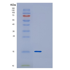 Recombinant Human DYNLT3 Protein,Recombinant Human DYNLT3 Protein