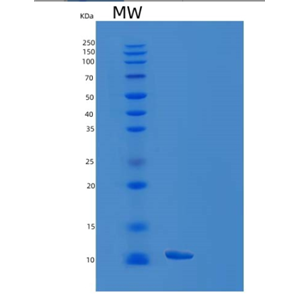 Recombinant Human EAF1 Protein,Recombinant Human EAF1 Protein