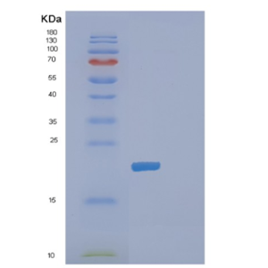 Recombinant Human DHFR Protein