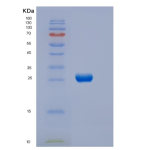 Recombinant Human DTYMK Protein,Recombinant Human DTYMK Protein