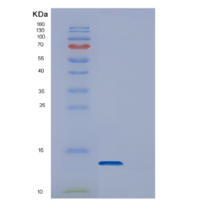 Recombinant Human DYNLL1 Protein,Recombinant Human DYNLL1 Protein