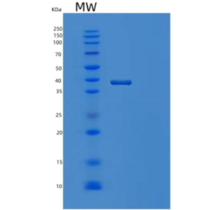 Recombinant Human DYRK1A Protein,Recombinant Human DYRK1A Protein