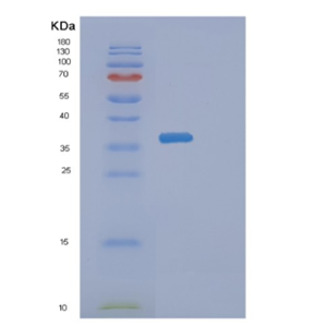 Recombinant Human DIMT1 Protein,Recombinant Human DIMT1 Protein