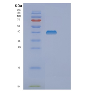 Recombinant Human DUSP10 Protein,Recombinant Human DUSP10 Protein