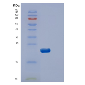 Recombinant Human DUSP3 Protein