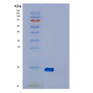 Recombinant Human DYNLT1 Protein