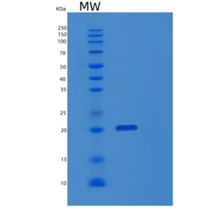 Recombinant Human EBAG9 Protein,Recombinant Human EBAG9 Protein