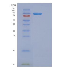 Recombinant Human DMGO (Dimethylglycine oxidase) Arthrobacter globiformis Protein