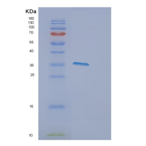 Recombinant Human DPPA4 Protein,Recombinant Human DPPA4 Protein